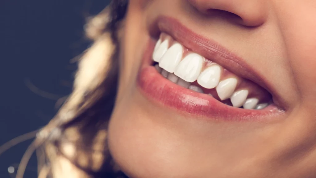 best price for porcelain veneers in turkey