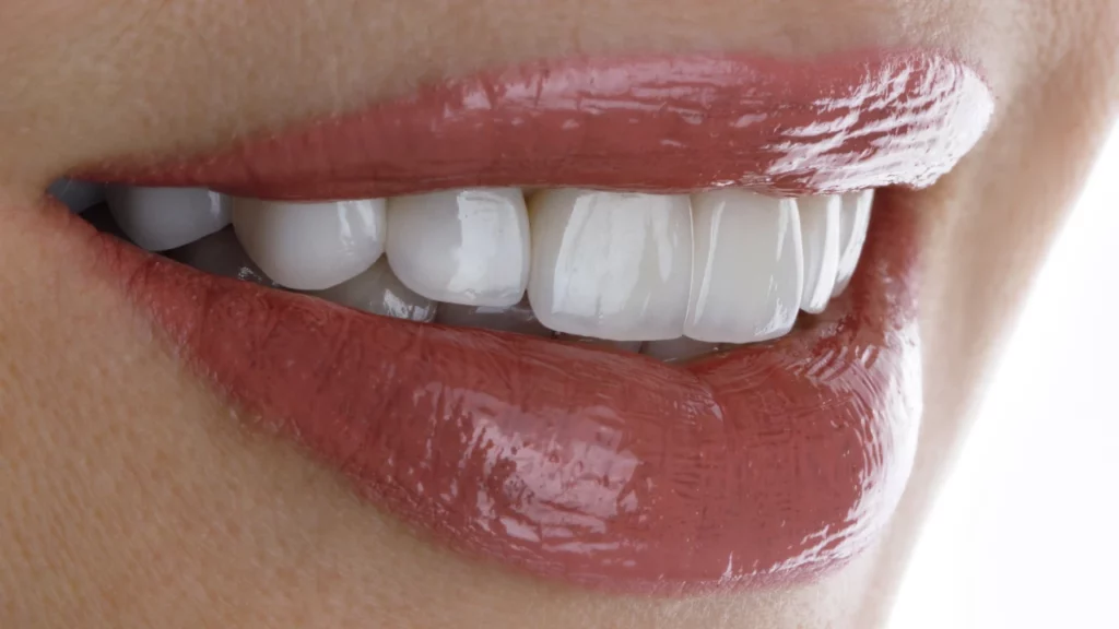 translucent teeth and transparent teeth