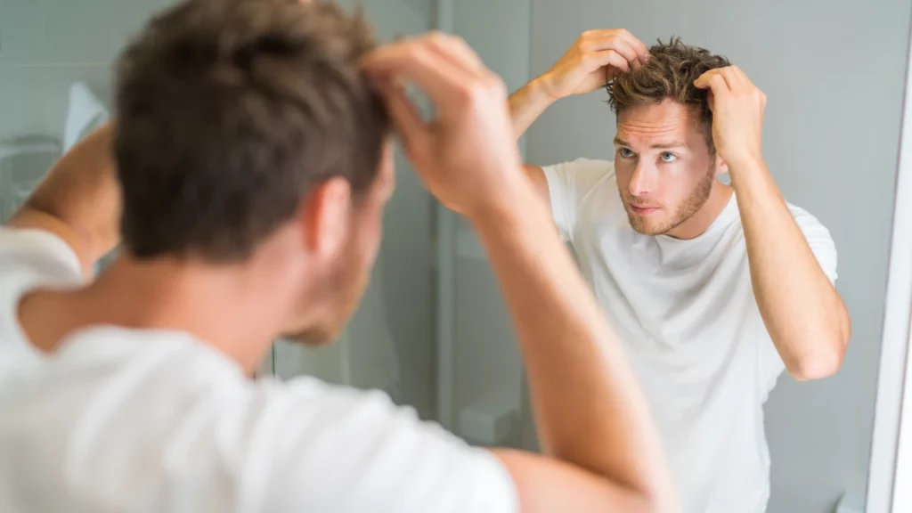 managing shock loss in hair transplant