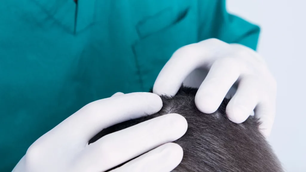 donor area in hair transplant