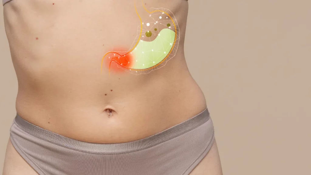 liposuction side effects