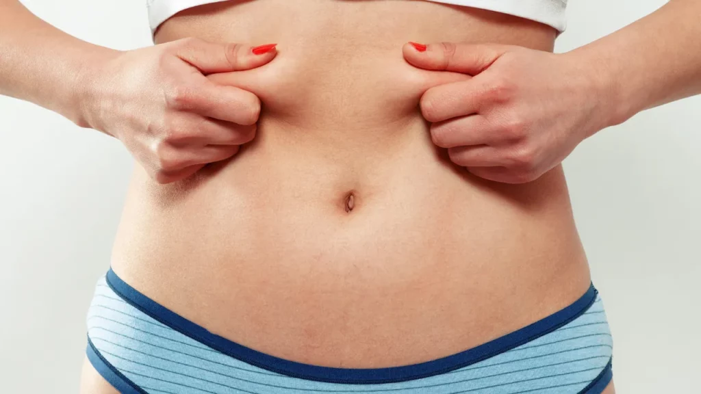 symptoms of seroma after liposuction